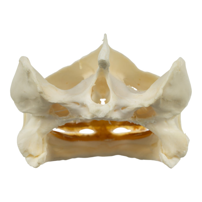 Real Snapping Turtle Skull - Large (Pathology)
