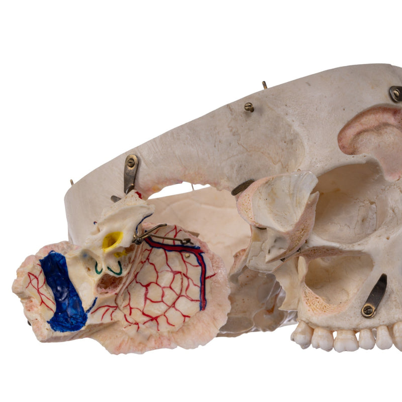 Real Human Skull - Dissected