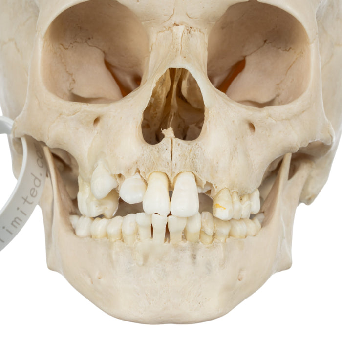 Real Human Child Skull