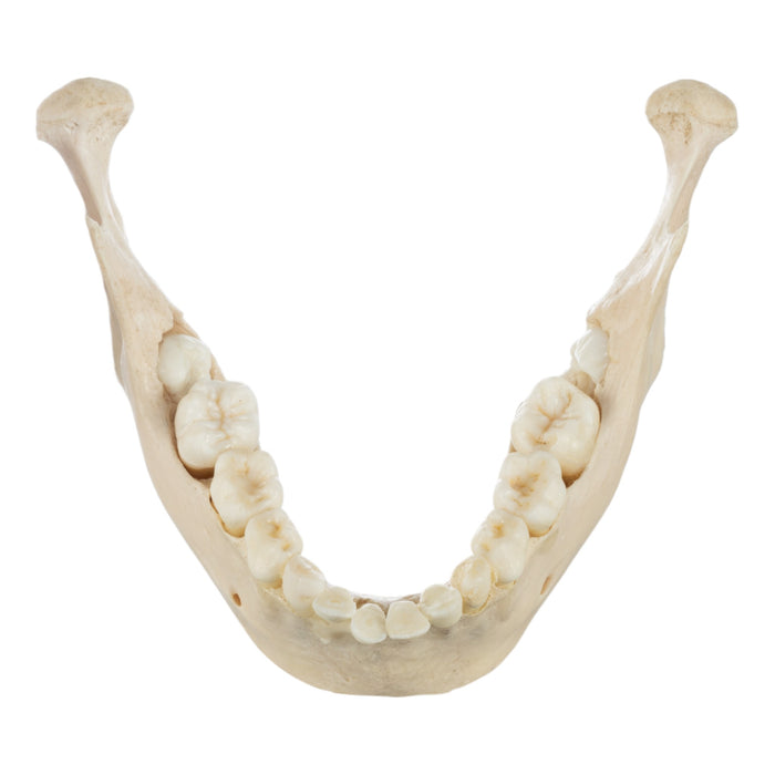 Real Human Child Skull