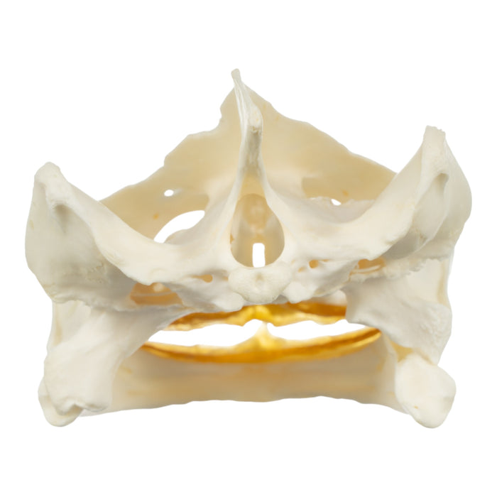 Real Snapping Turtle Skull - Large (Pathology)
