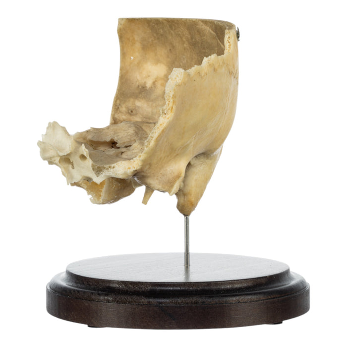 Real Human Partial Skull on Stand
