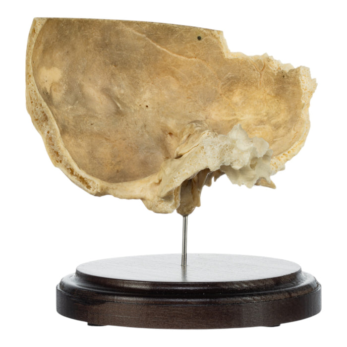 Real Human Partial Skull on Stand