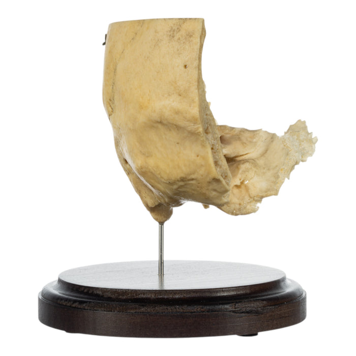 Real Human Partial Skull on Stand