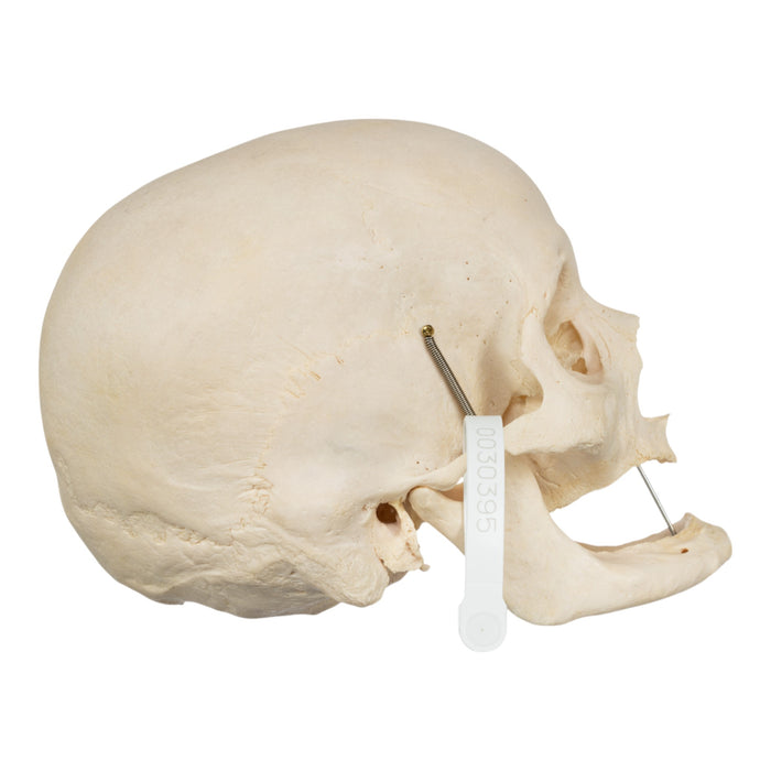 Real Human Skull