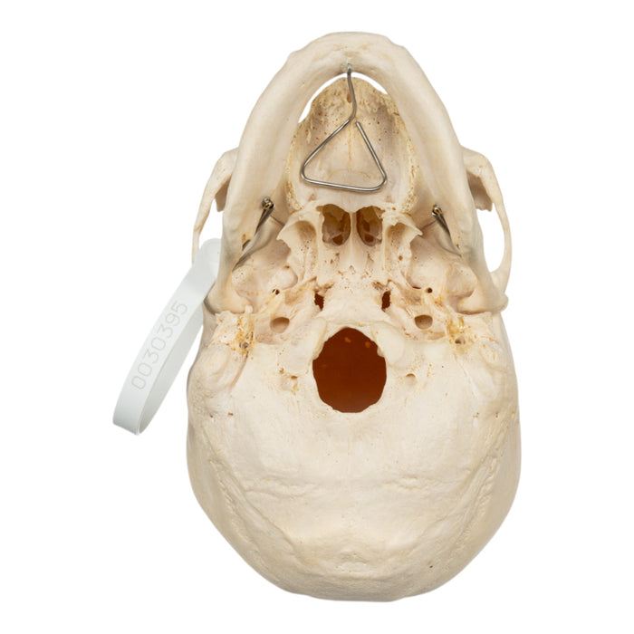 Real Human Skull