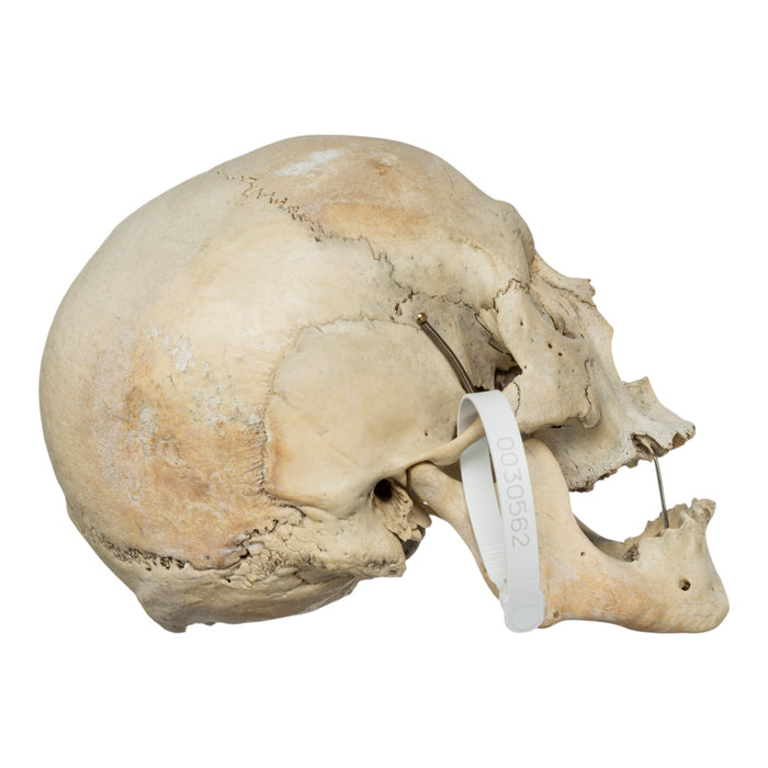 Real Human Skull