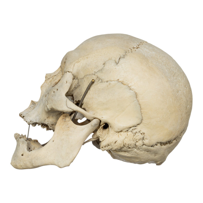 Real Human Skull
