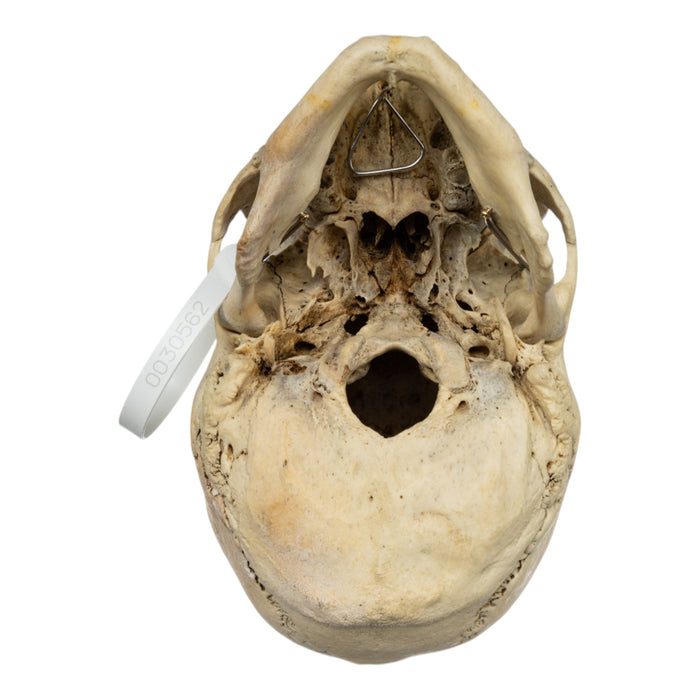 Real Human Skull