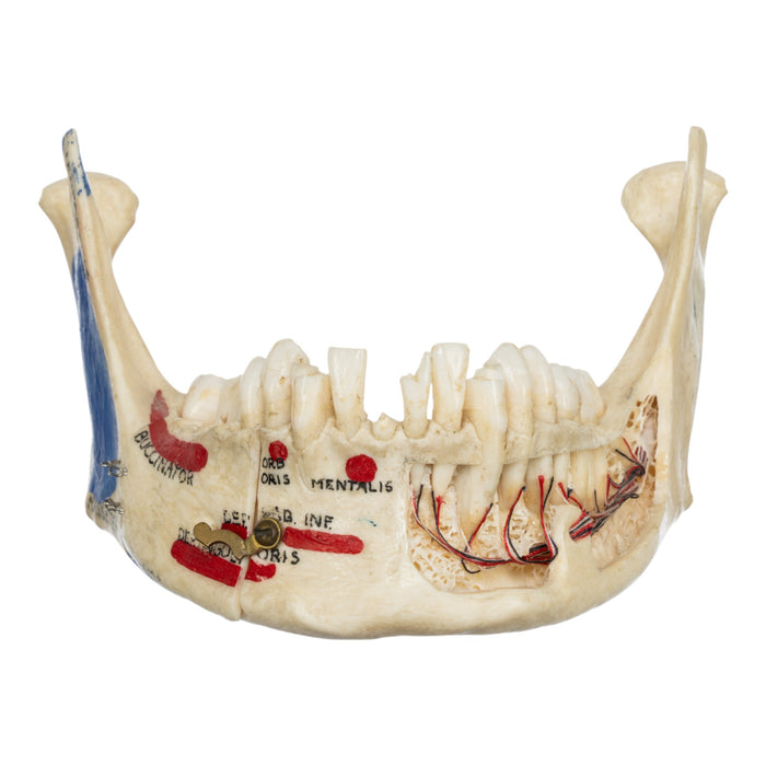 Real Human Mandible - Dissected