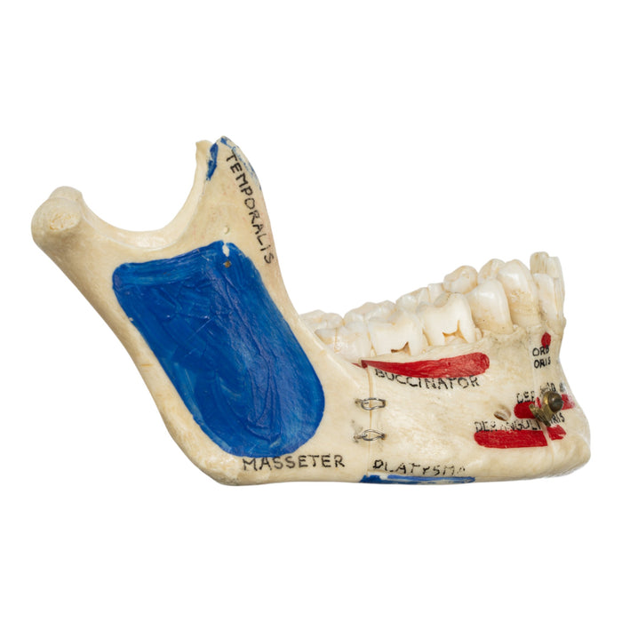 Real Human Mandible - Dissected