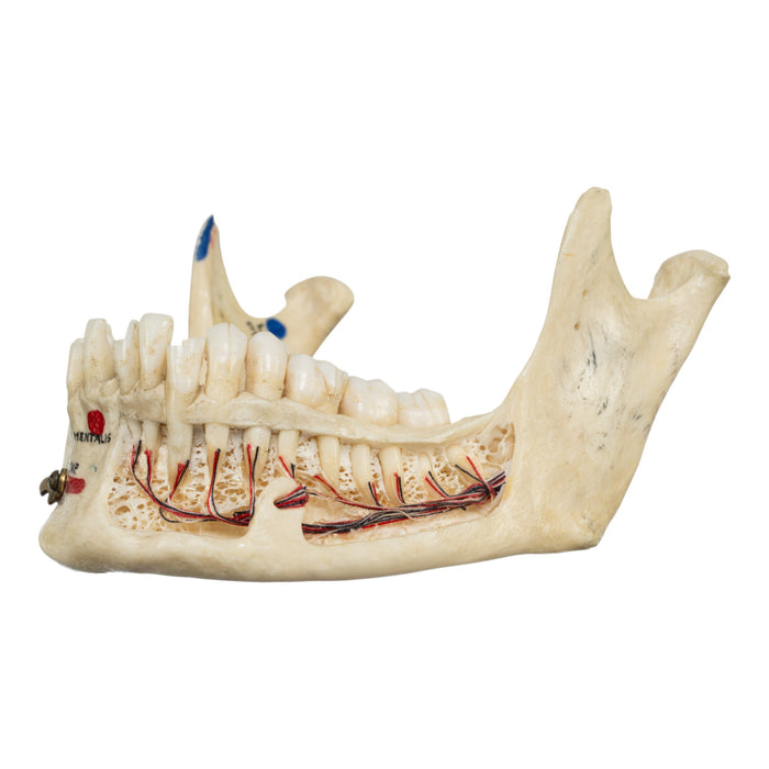 Real Human Mandible - Dissected