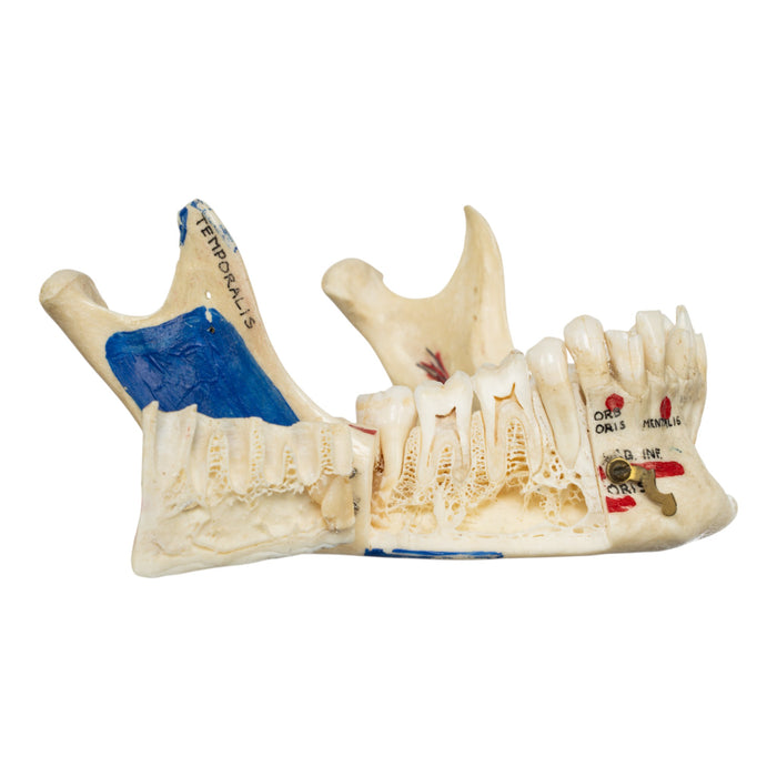Real Human Mandible - Dissected