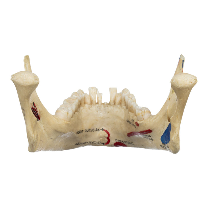 Real Human Mandible - Dissected