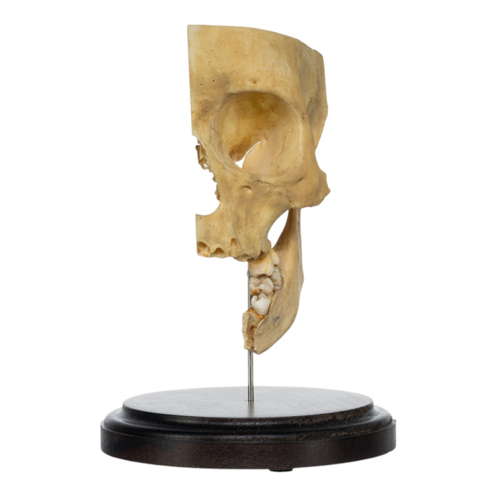 Real Human Partial Skull on Stand