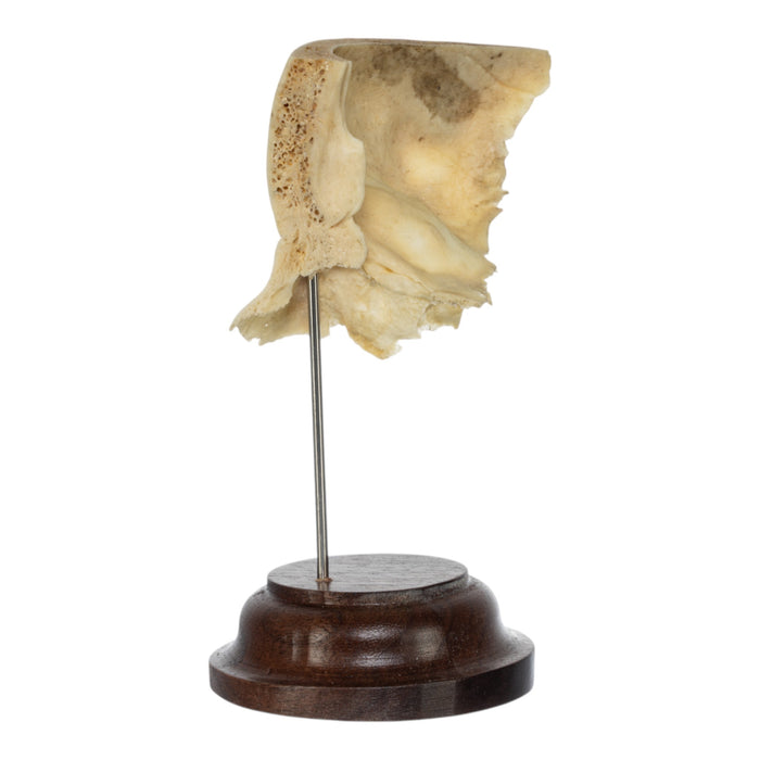Real Human Partial Skull on Stand
