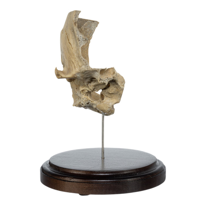 Real Human Partial Skull on Stand