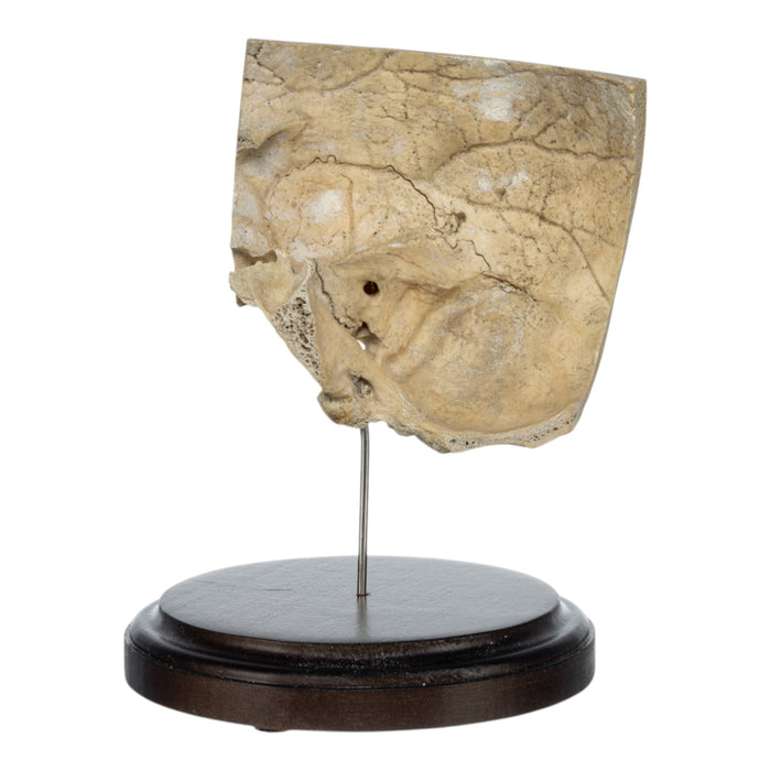Real Human Partial Skull on Stand