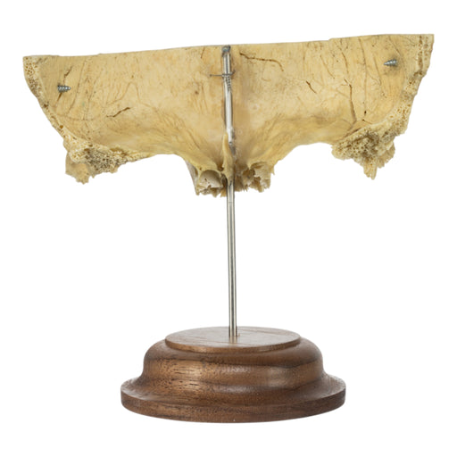 Real Human Partial Frontal Bone on Stand