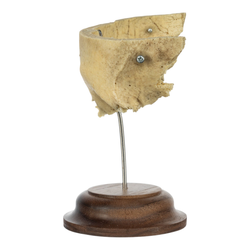 Real Human Partial Frontal Bone on Stand