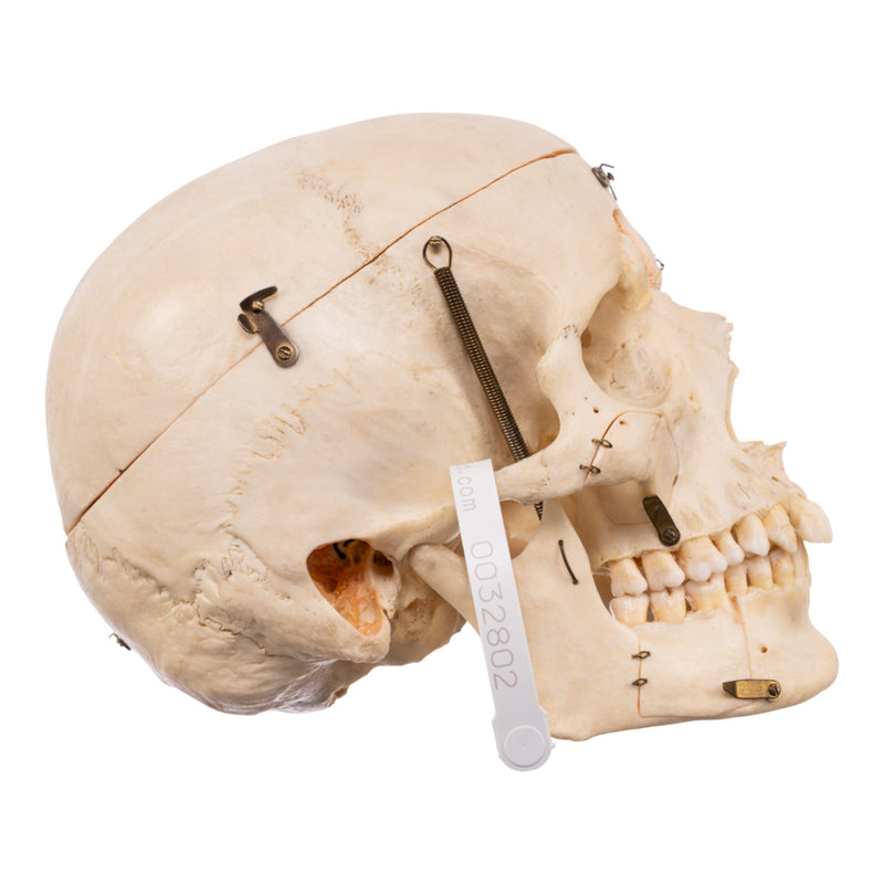 Real Human Skull - Dissected - With Stand