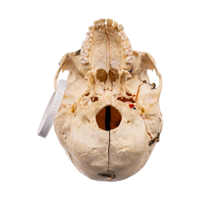 Real Human Skull - Dissected - With Stand