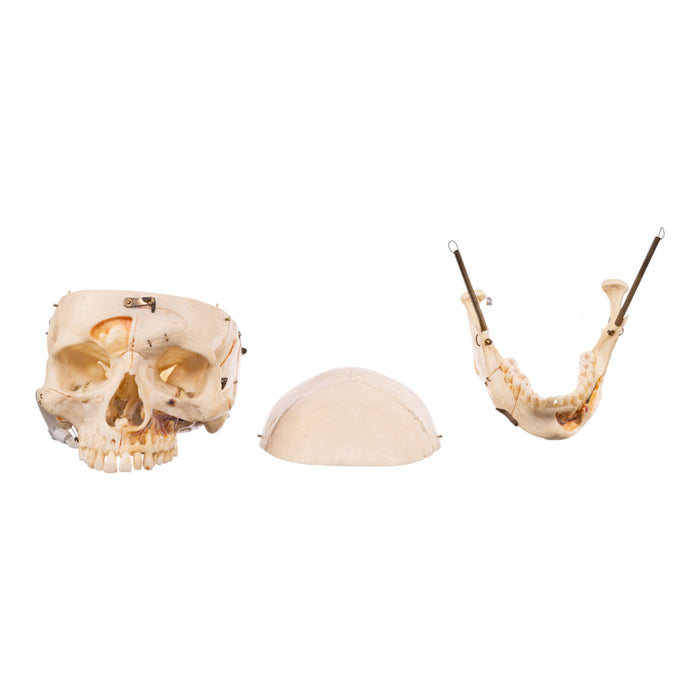 Real Human Skull - Dissected - With Stand