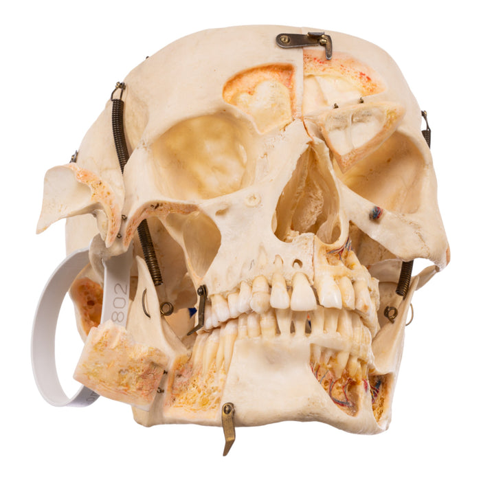 Real Human Skull - Dissected - With Stand