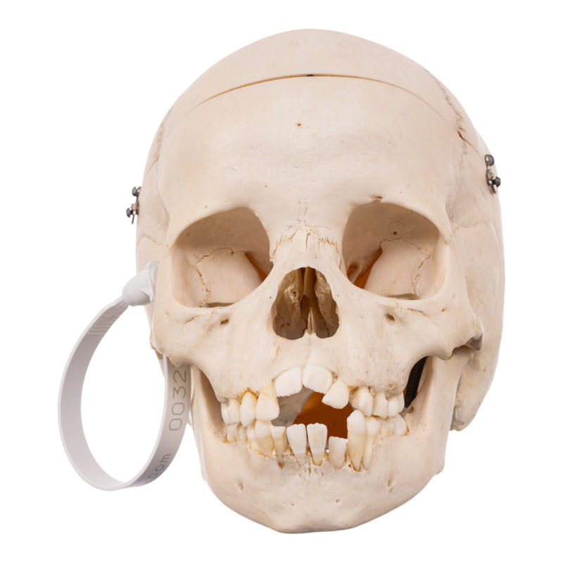 Real Child Human Skull With Case