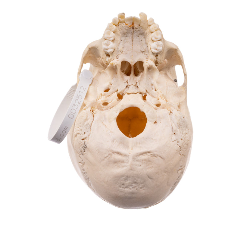 Real Child Human Skull With Case