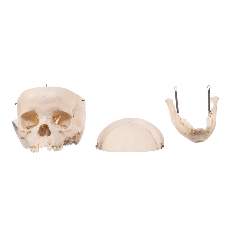Real Child Human Skull With Case