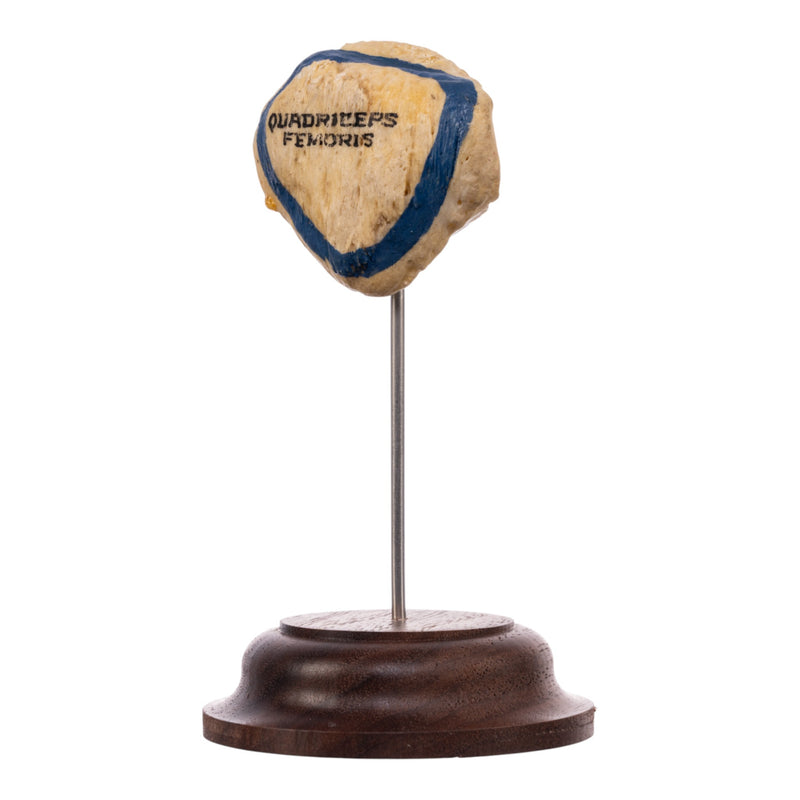 Real Human Patella - On Stand