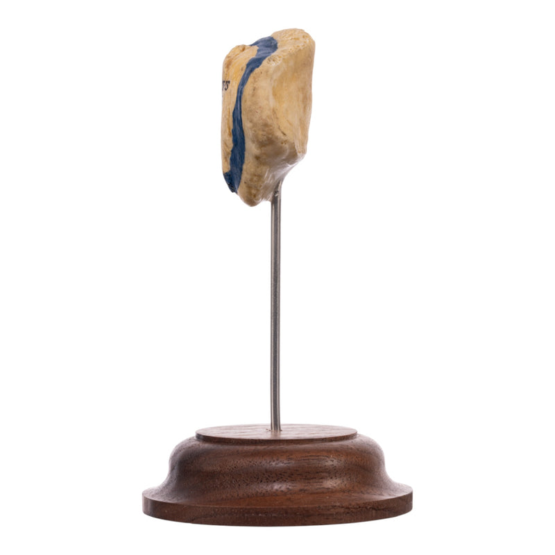 Real Human Patella - On Stand