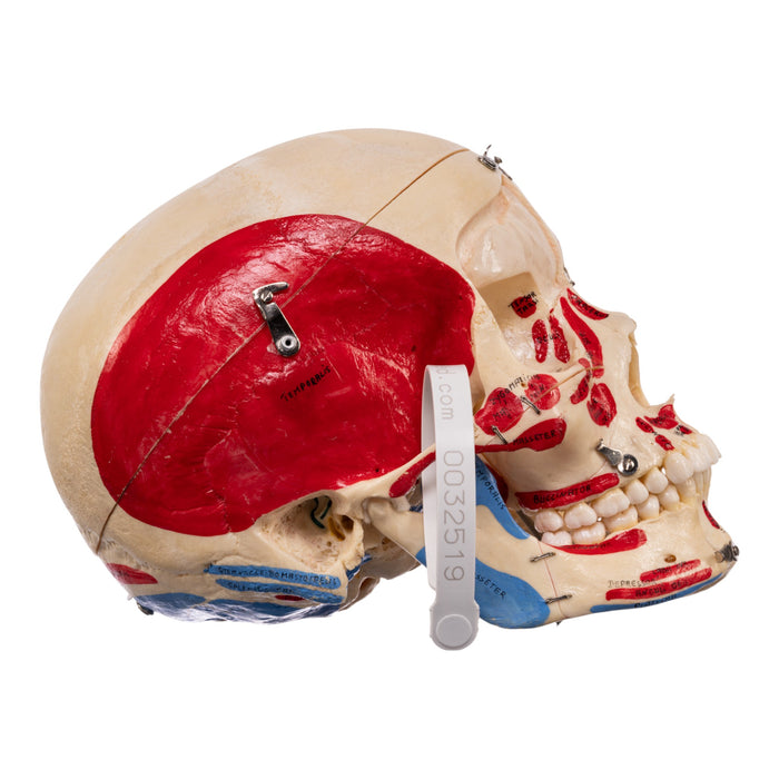 Real Human Skull - Dissected