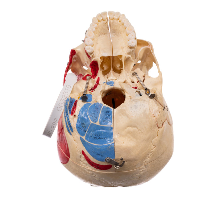 Real Human Skull - Dissected