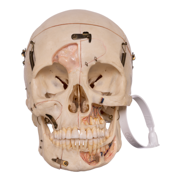 Real Human Skull - Dissected with Carrying Case