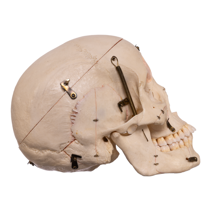 Real Human Skull - Dissected with Carrying Case