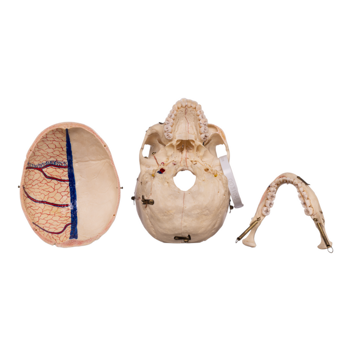 Real Human Skull - Dissected with Carrying Case