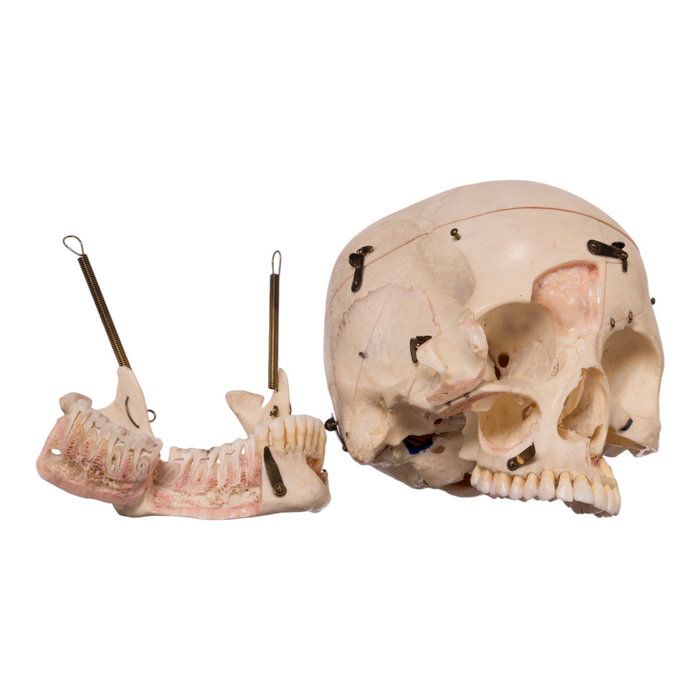 Real Human Skull - Dissected with Carrying Case