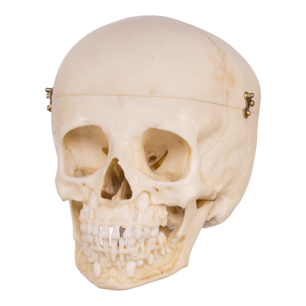 Replica 6-year-old Human Child Skull With Exposed Dentition For