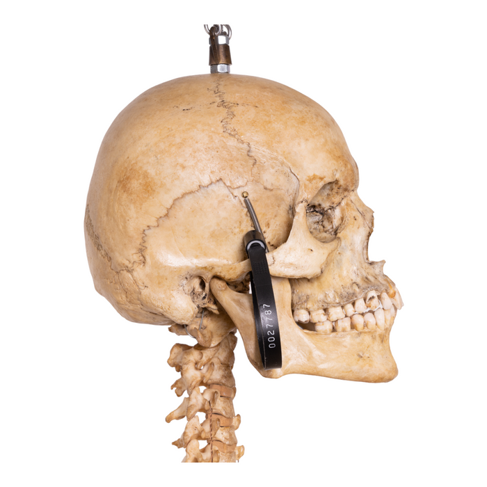Real Human Skeleton - Articulated Antique — Skulls Unlimited