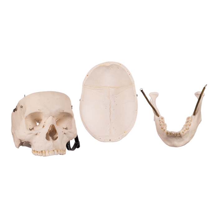 Real Human Skull