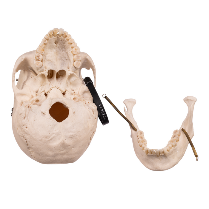 Real Human Skull