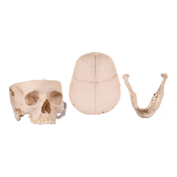 Real Human Skull