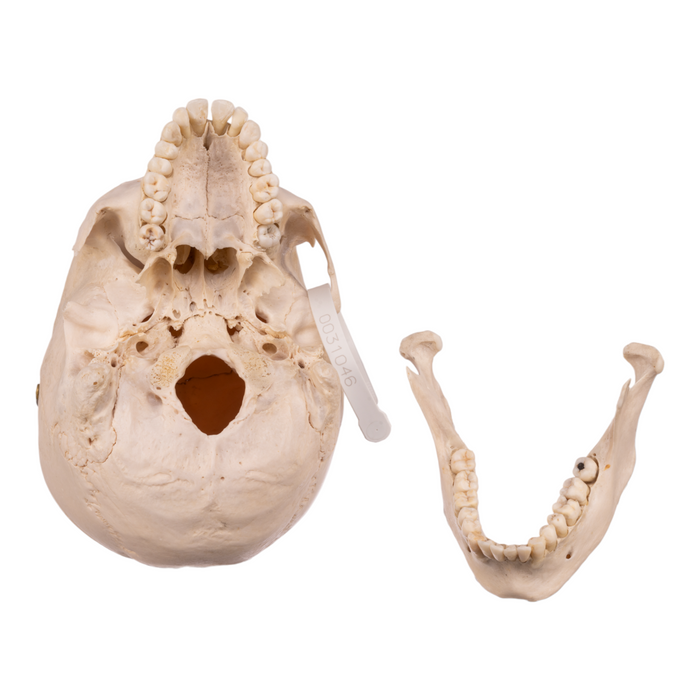 Real Human Skull