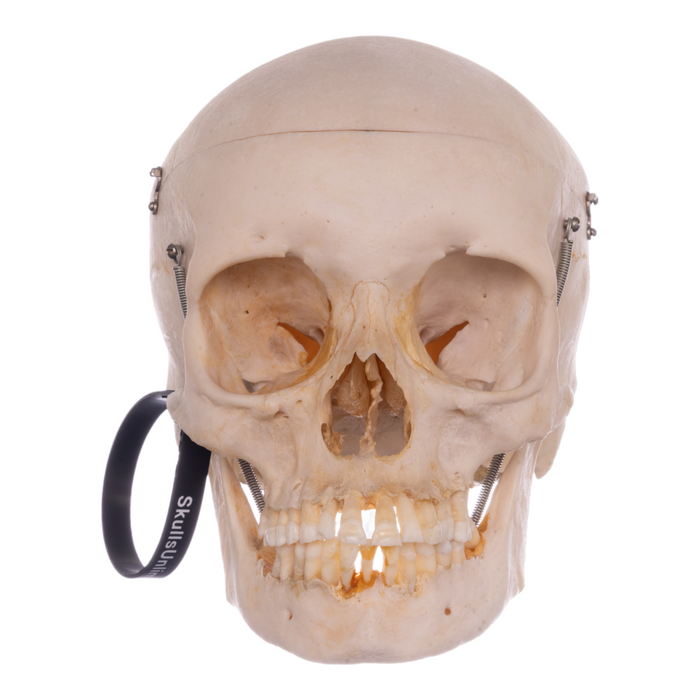 Real Human Skull