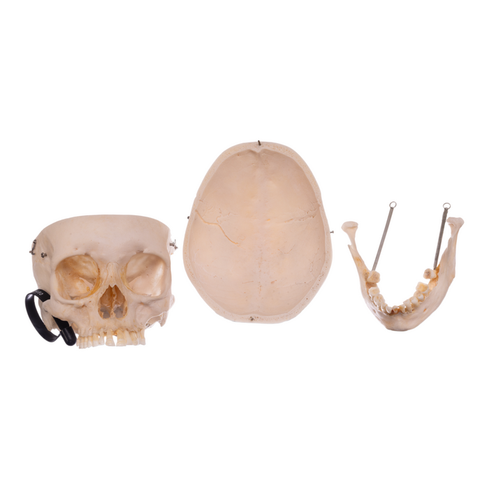 Real Human Skull