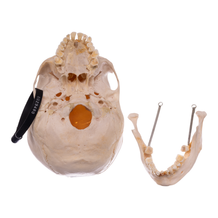 Real Human Skull