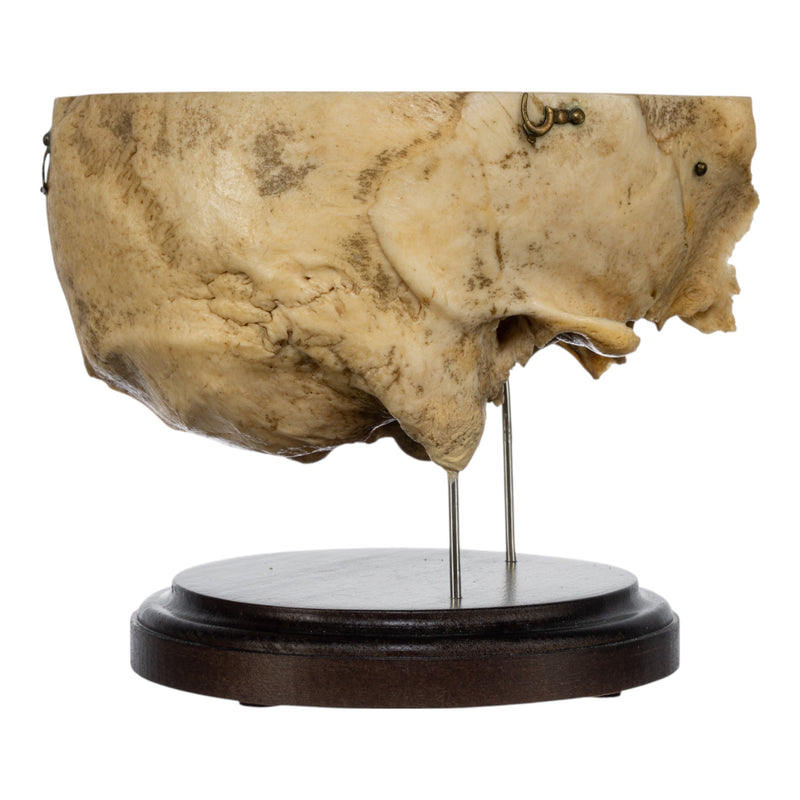 Real Human Partial Skull on Stand