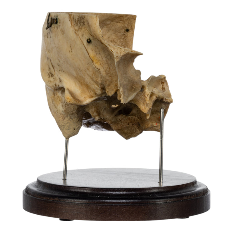 Real Human Partial Skull on Stand